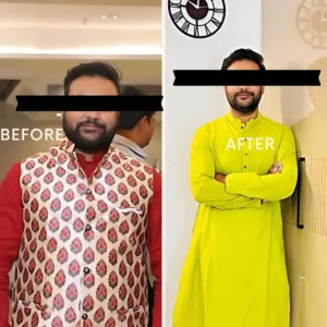 Weight loss Transformation