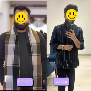 Weight loss Transformation
